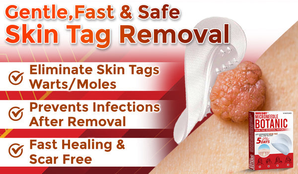 ✅👩⚕️ DarkFairy® MicroNeedle Botanic Skin Tag Removal Patch 🇺🇸 Made in the USA