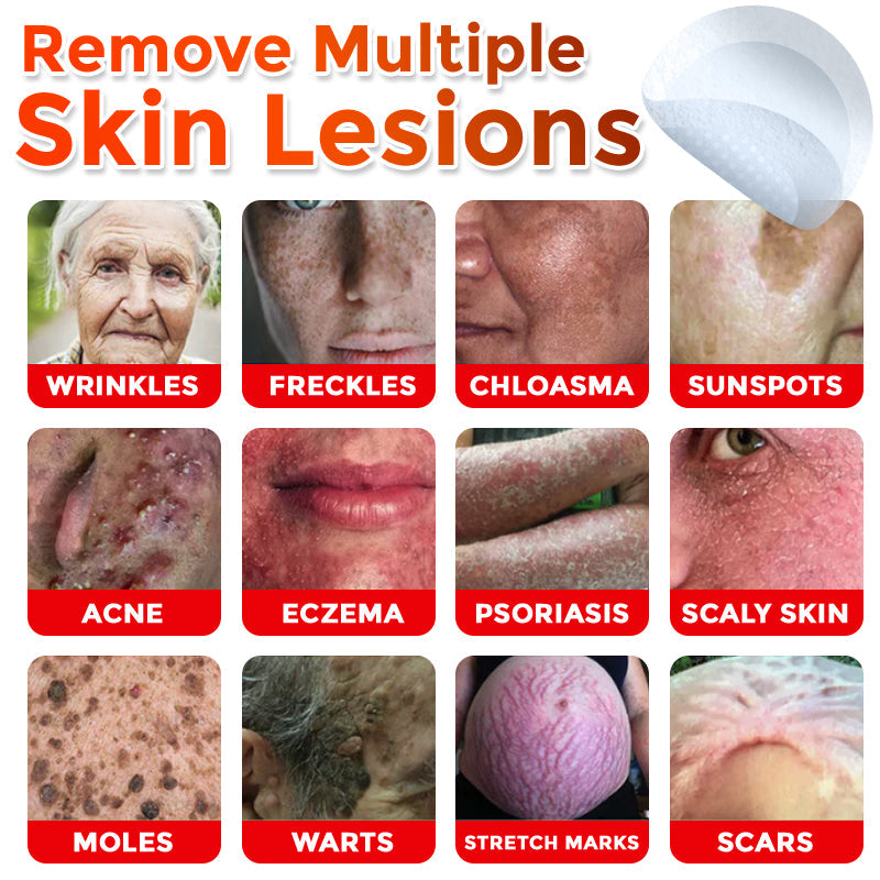 ✅👩⚕️ DarkFairy® MicroNeedle Botanic Skin Tag Removal Patch 🇺🇸 Made in the USA